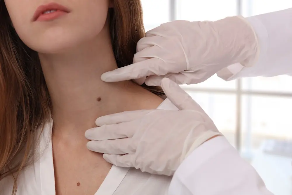 Ein Dermatologe untersucht einen Leberfleck am Hals einer Frau